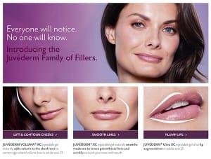 Illustration of benefits of Juvederm