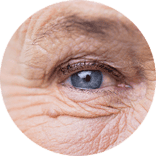Aging Skin