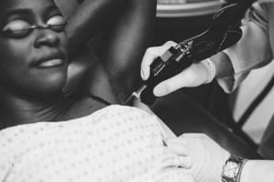 Underam Laser hair removal