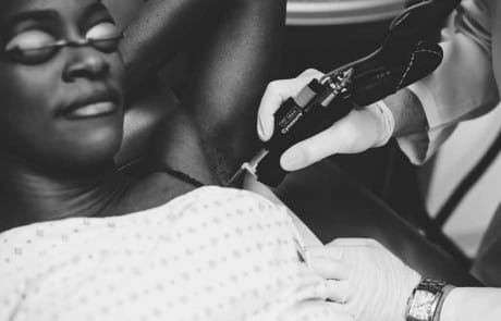 Underam Laser hair removal