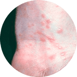 Rash-like Conditions