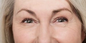 Example of facial wrinkles