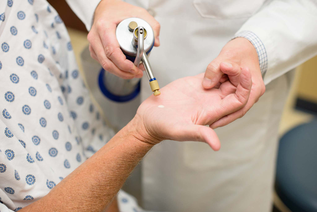Doctor applying freezing treatment to patients hand